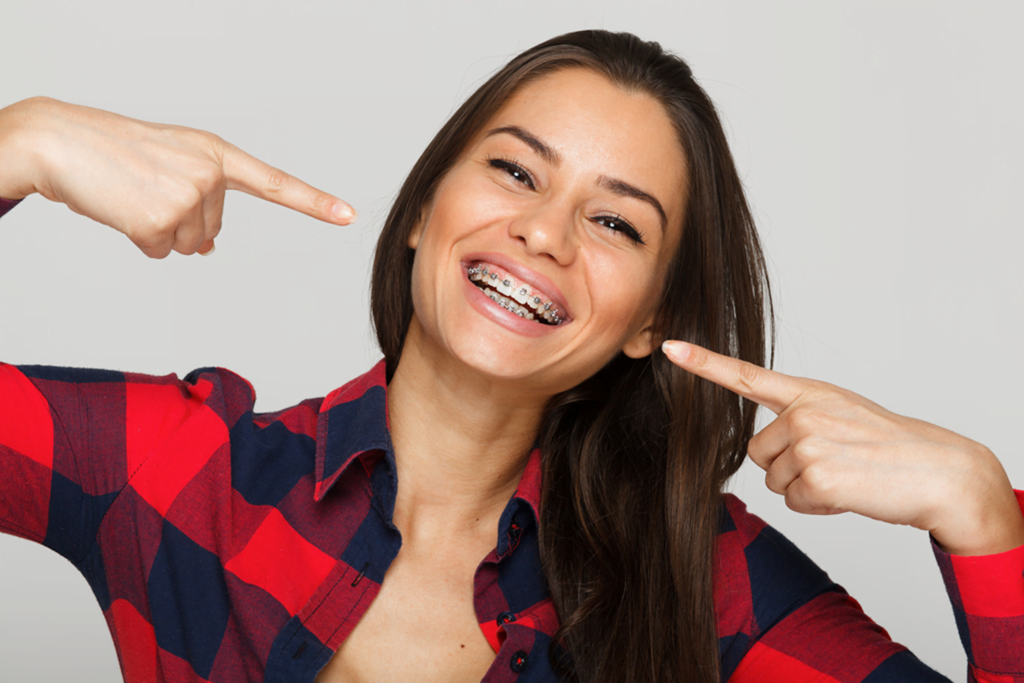 Dental Braces in St.Albert